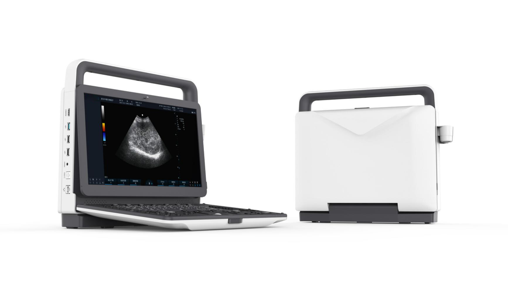 Portable Color Doppler Ultrasound System With Convex and LinearProbe, Lithium Battery